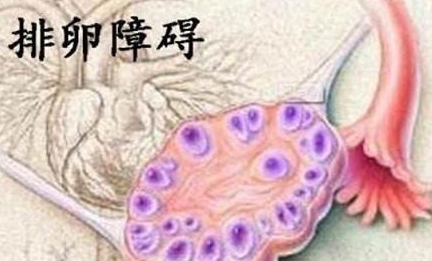 卵泡不排卵的原因是什么？